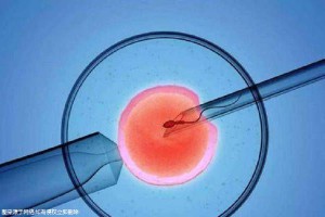 染色体易位